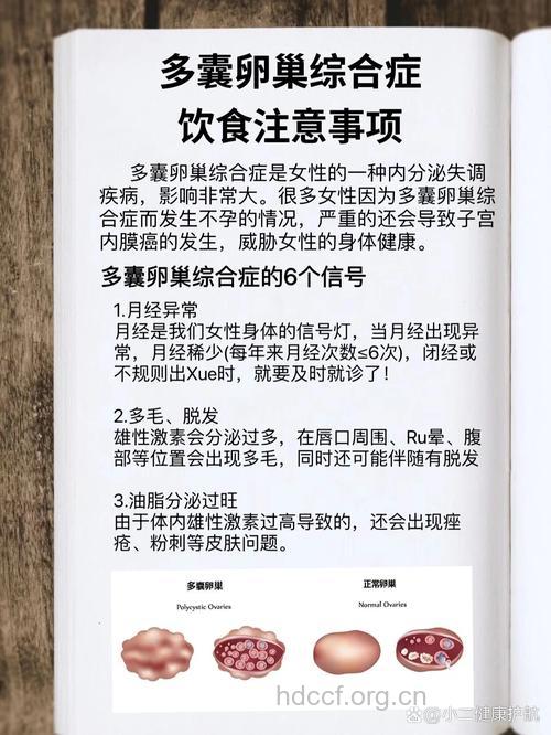多囊卵巢综合征患者的生活注意事项