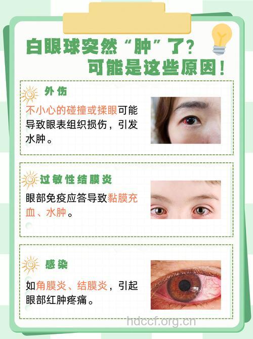 眼睛突然浮肿的原因