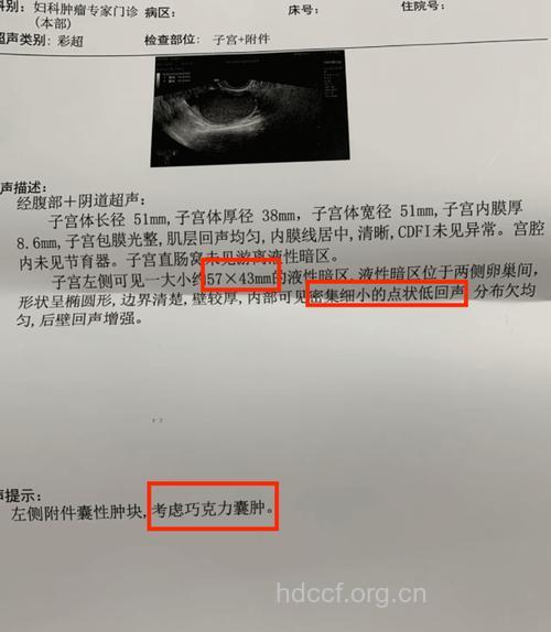 巧克力囊肿 不孕＂定时炸弹＂