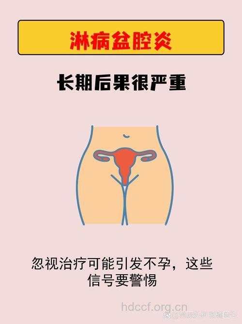 淋病性盆腔炎该如何治疗?