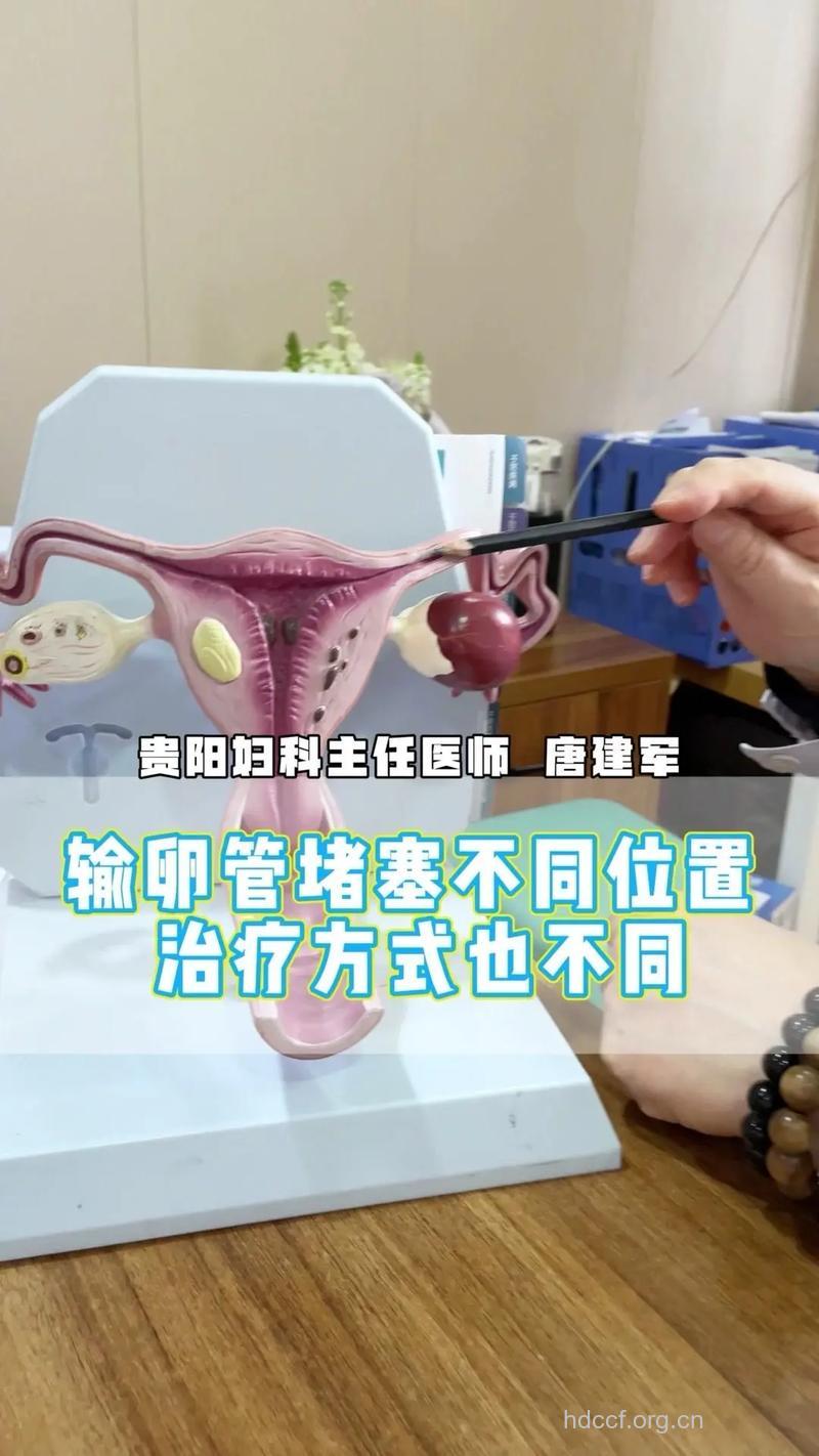 输卵管不通的治疗--输卵管重建术