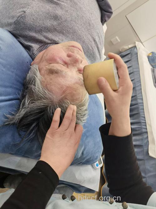 中医治疗青光眼