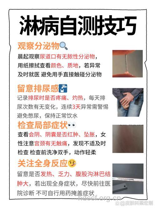 自测:你得淋病了吗?