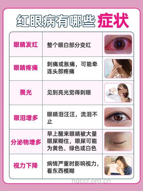 怎样治疗红眼病?