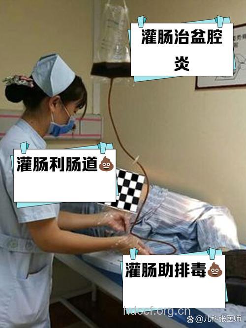 治疗盆腔感染 中药内服、外敷加灌肠
