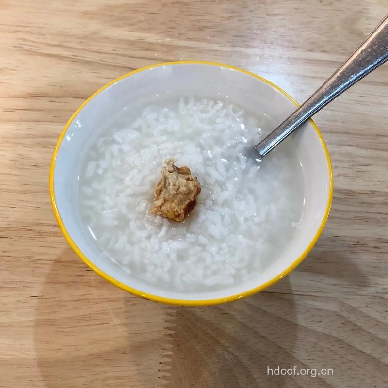 常煲电话粥易致白内障