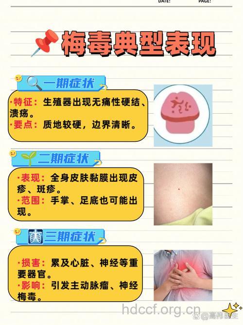 揭秘！淋病梅毒缠上你的“内幕”