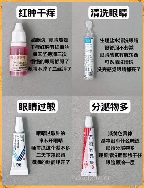 夏天患了红眼病,切忌用眼膏