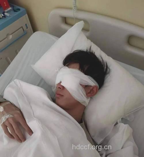 患红眼病切忌包扎眼睛