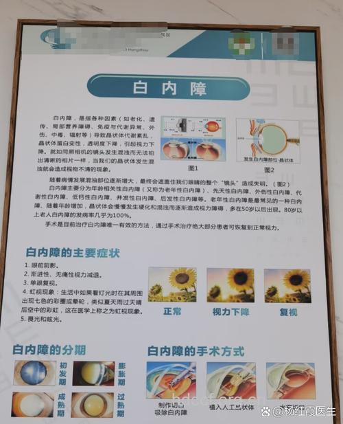 激光治疗白内障有效吗？