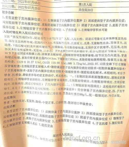 子宫内膜异位症必须早就医早诊断
