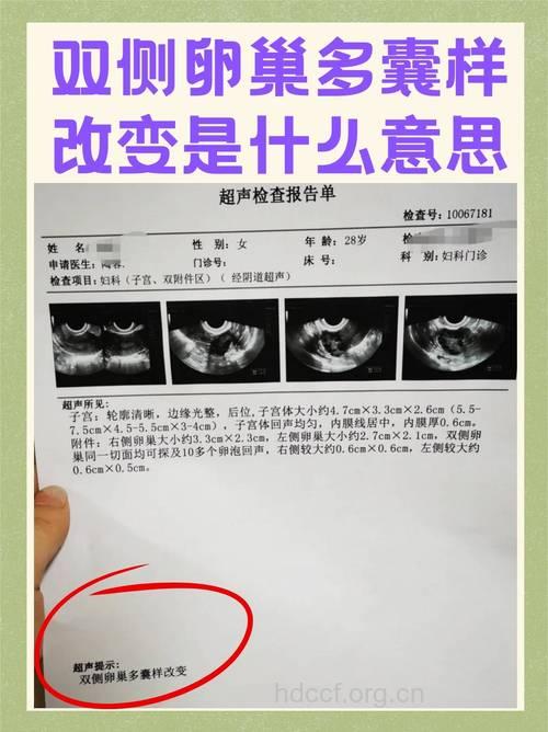 女性子宫发育不良的诊断