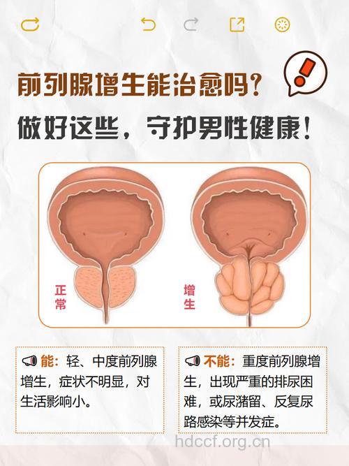 前列腺自述 男人都来看一看
