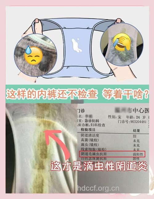 如何诊断滴虫病