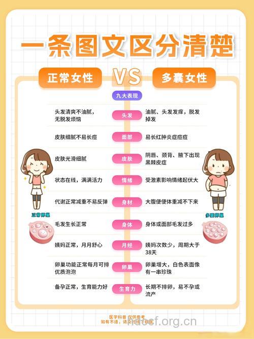 如何鉴别多囊卵巢综合症