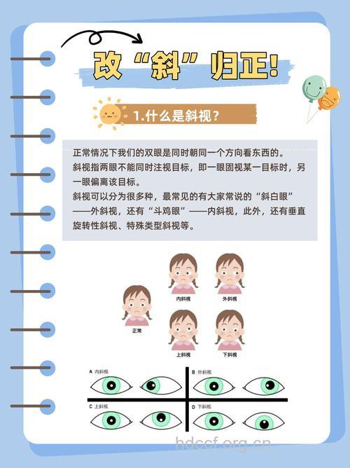 为什么儿童容易发生斜视？