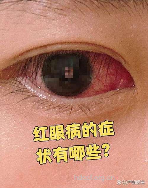 真假红眼病