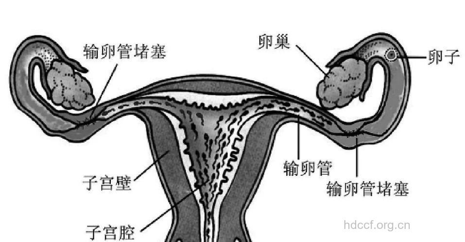 输卵管为何会如此脆弱?