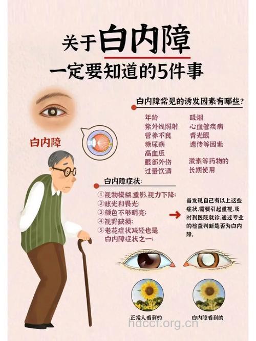 老花眼消失乃白内障作祟
