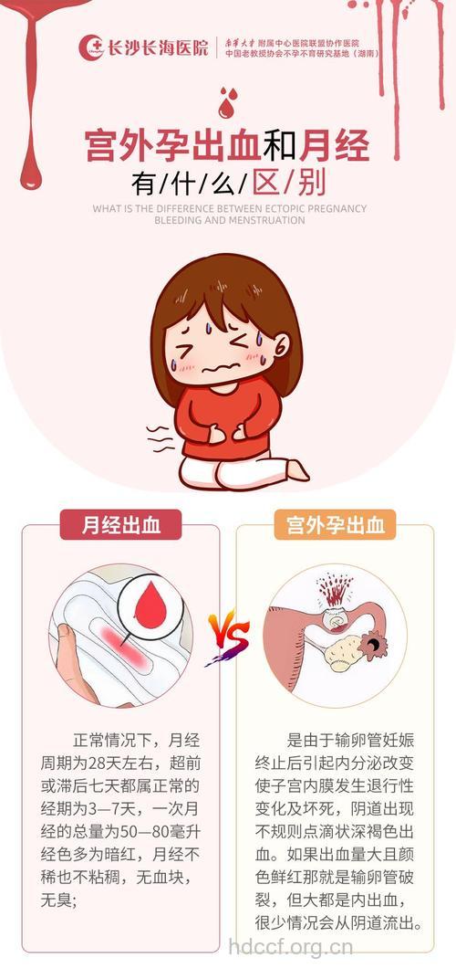 “大姨妈”停留 当心宫外孕