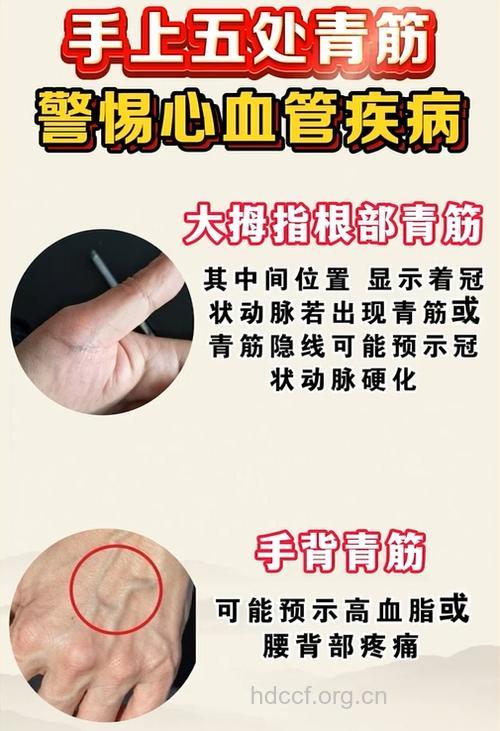 手掌青筋明显是怎么回事