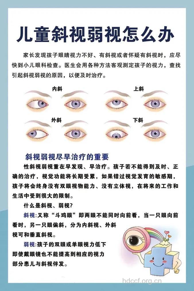 小孩斜视要重视治疗
