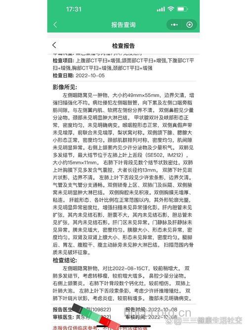 头颈部横纹肌肉瘤影响预后的因素