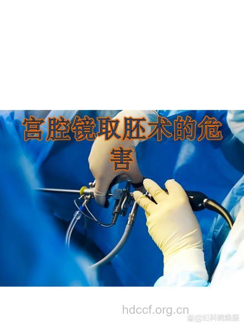 流产避免医源性不孕：宫腔取胚术