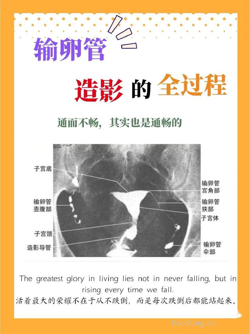 专家全面解析:输卵管造影