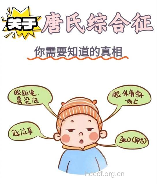 唐氏综合症的研究进展