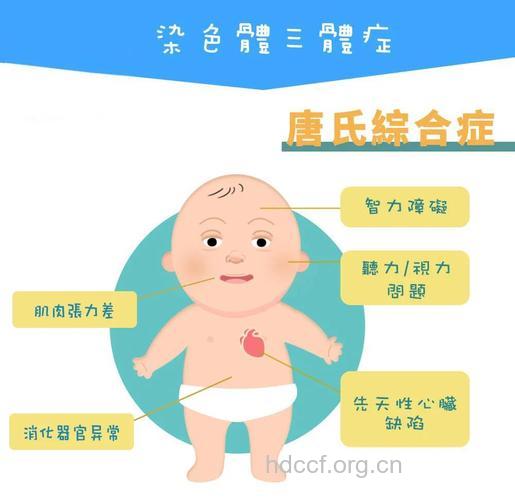 婴儿唐氏综合症的无创检验法