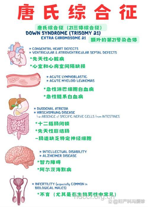 唐氏综合症是怎么一回事?