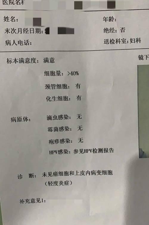 不孕检查:阴道脱落细胞检查
