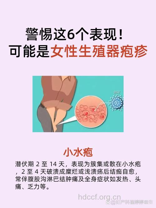 网友疑问:女性感染疱疹能怀孕吗?