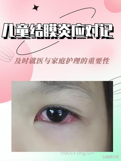 孩子红眼病要打消炎针吗？