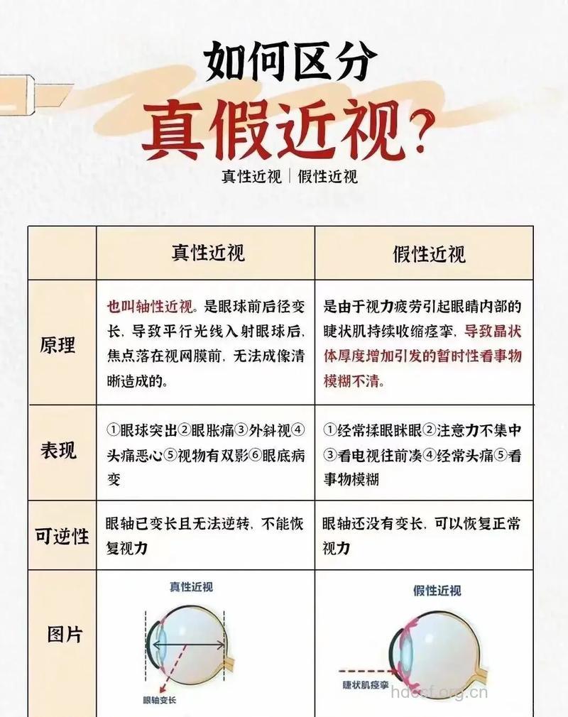 孩子近视,大都是真性近视