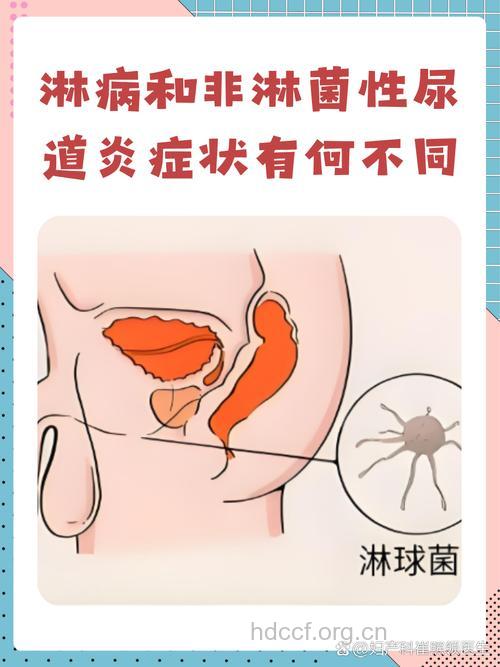 非淋菌性尿道炎症状有哪些