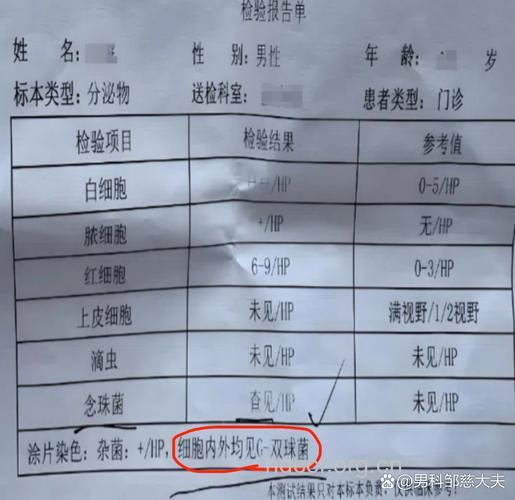 诊断非淋尿道炎的标准有哪些