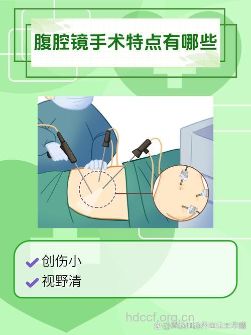 详解腹腔镜技术的应用