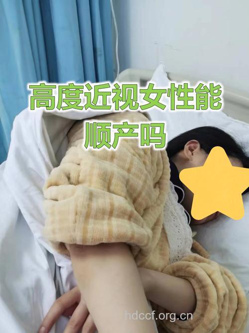 孕妇高度近视一定要剖腹产吗?