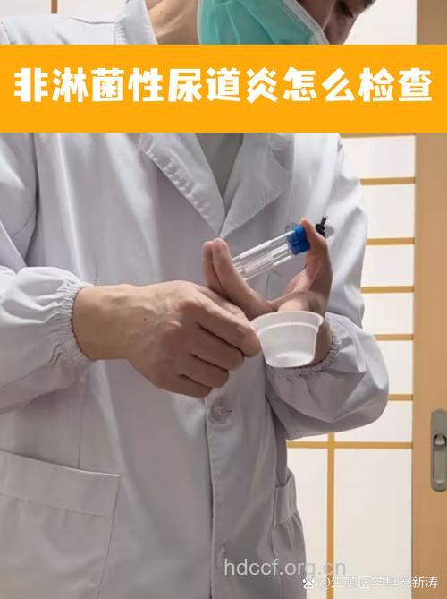 非淋菌性尿道炎的检查