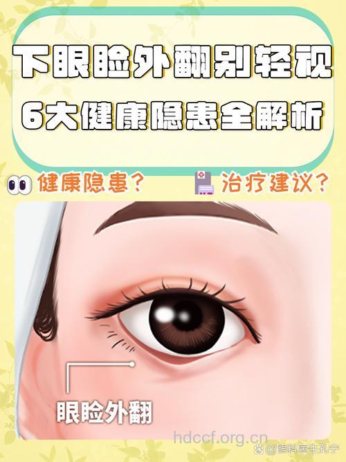 眼睑下坠者提防睑外翻