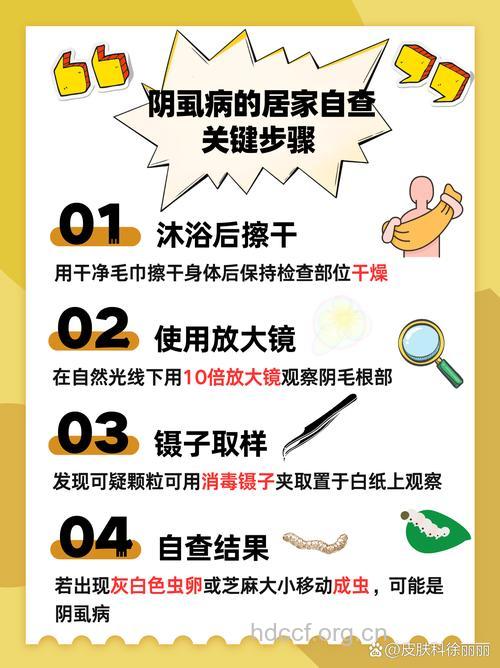 最常见的阴虱病检查方法