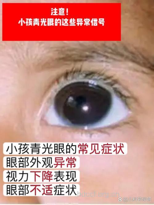 孩子为何“惹”上先天性青光眼