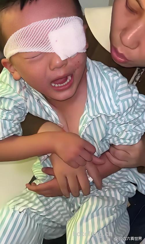 宝宝眼睛受伤怎么办?