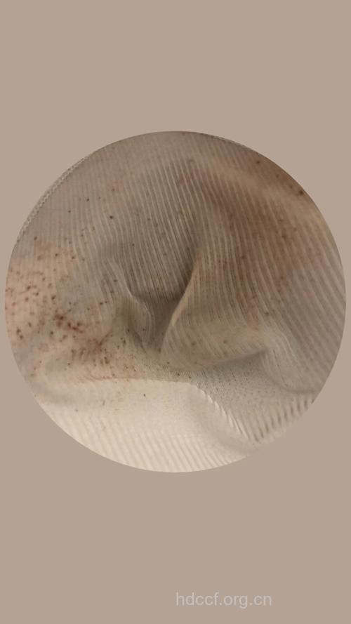 男性内裤有血斑小心阴虱病