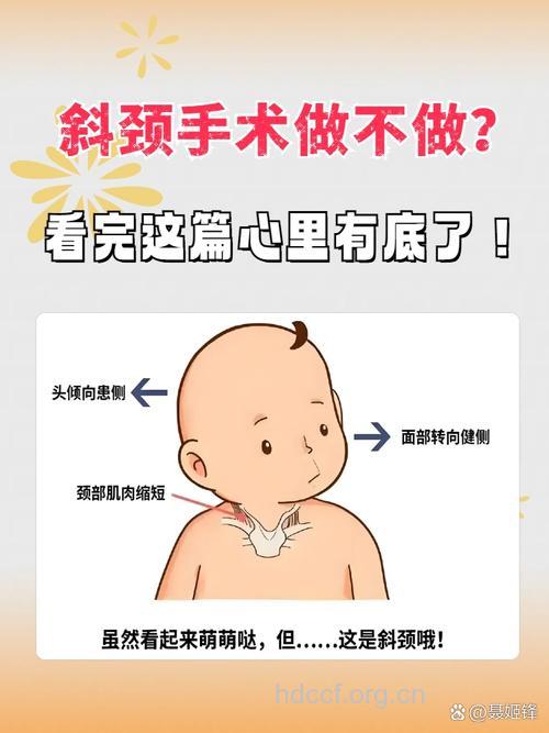 提醒:脖子歪一定要看眼科