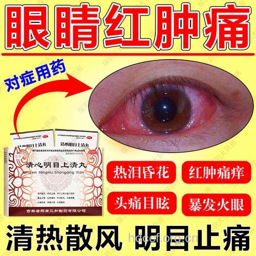 中医治疗红眼病效果佳