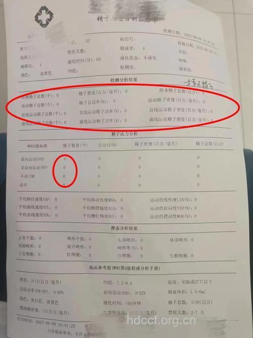 无精症需要做3个检查