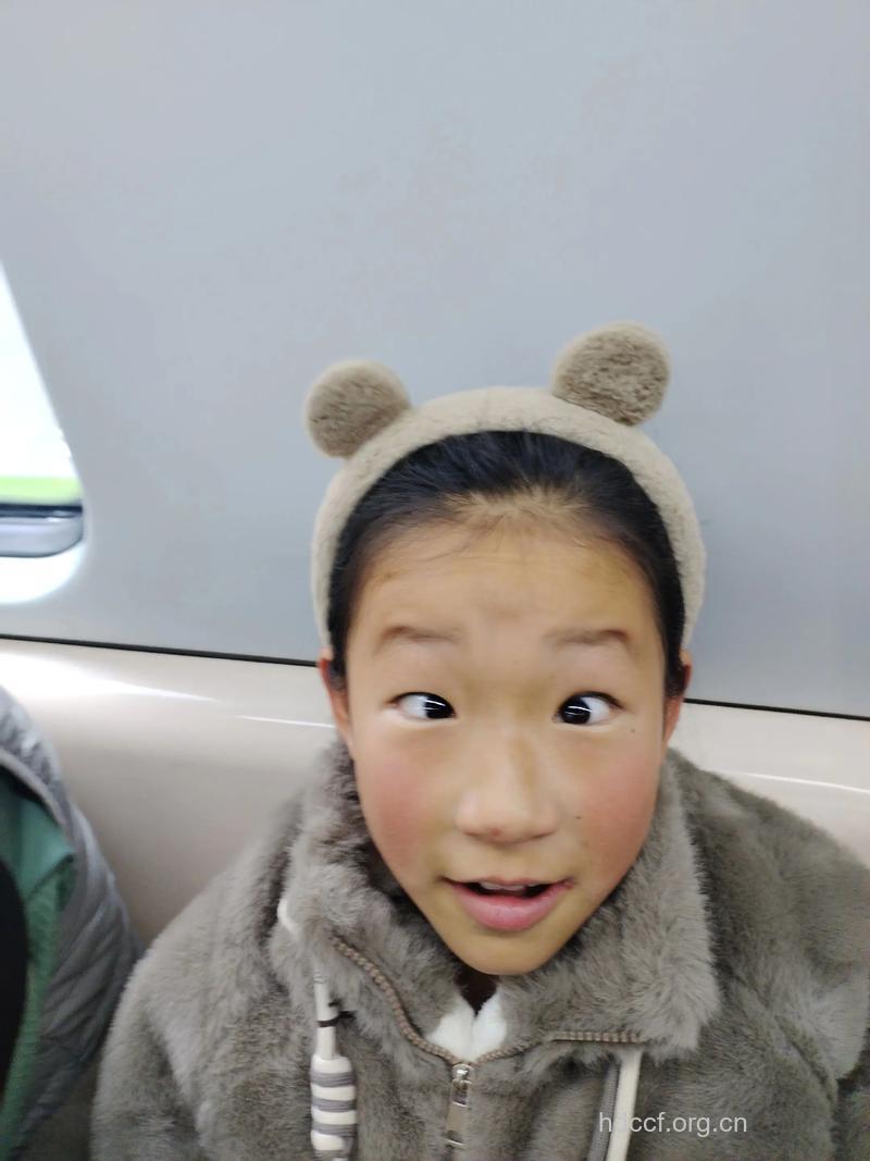 小儿“斗鸡眼”不可小视！